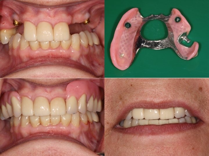 christine complex case