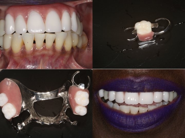 Patricia dental case