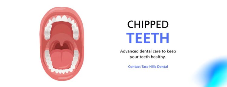 What to Do If You Have a Chipped Tooth in Pinole